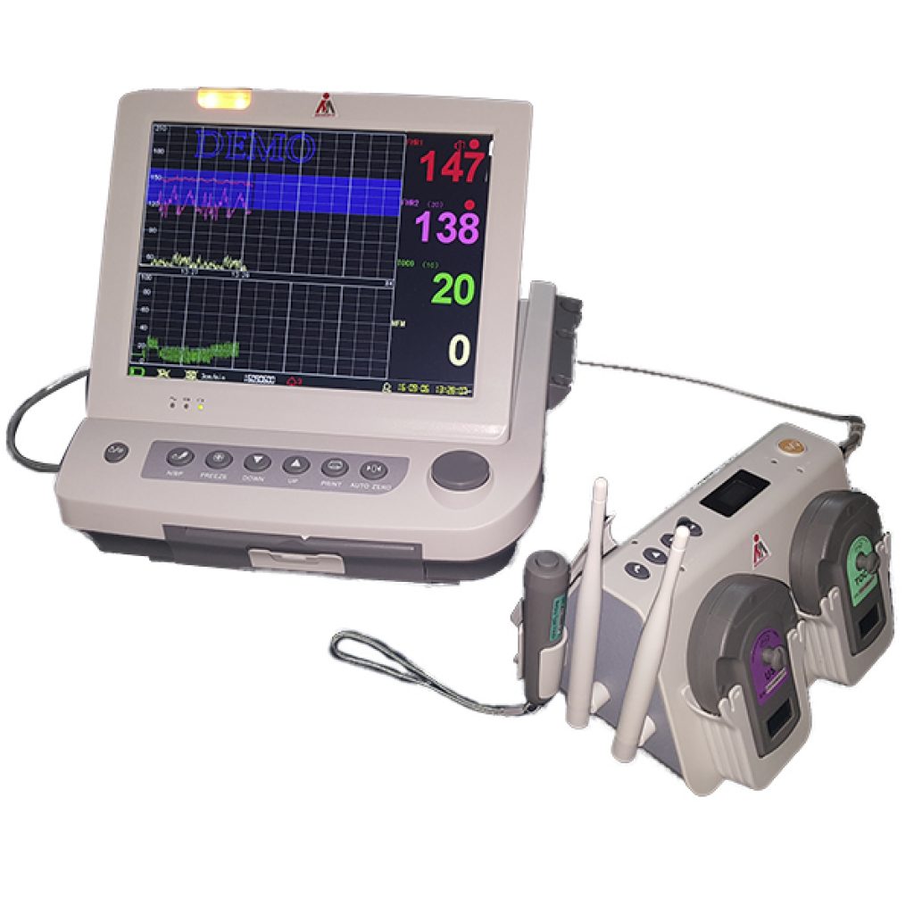 FETAL MONITOR (Wireless) Mediserve Group